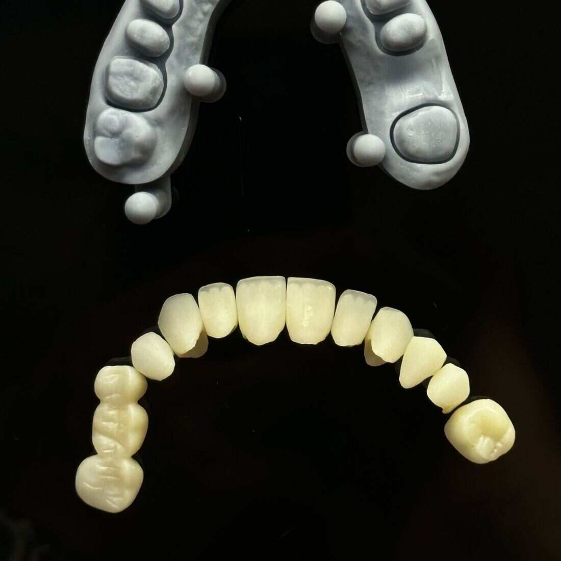 Crowns dental treatment at Waterford Dental Associates