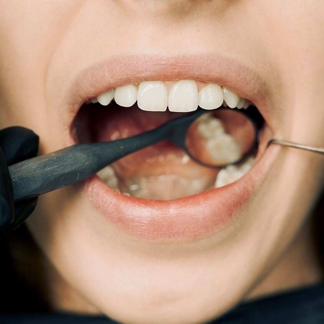Periodontics dental treatment at Waterford Dental Associates