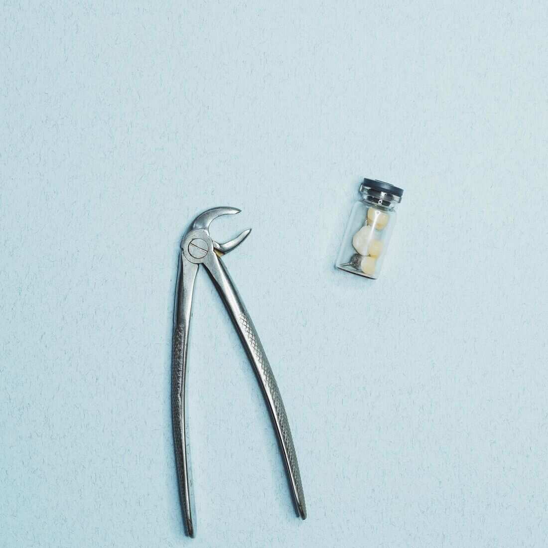 Tooth Extraction dental treatment at Waterford Dental Associates